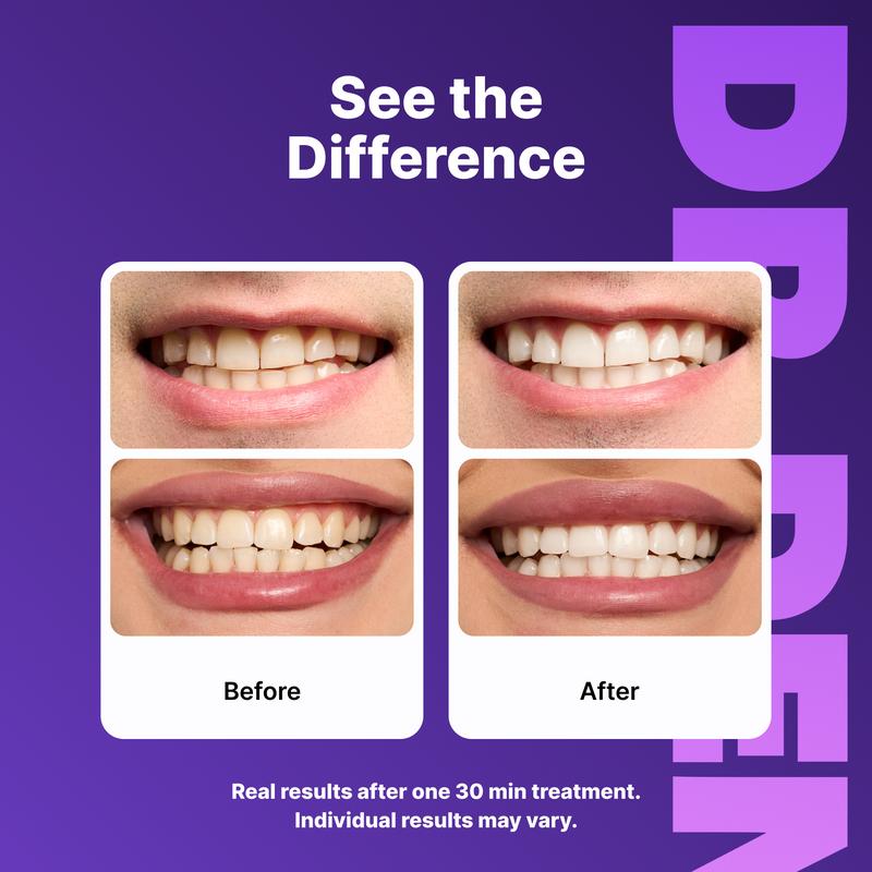 Purple Teeth Whitening Strips - Image 4
